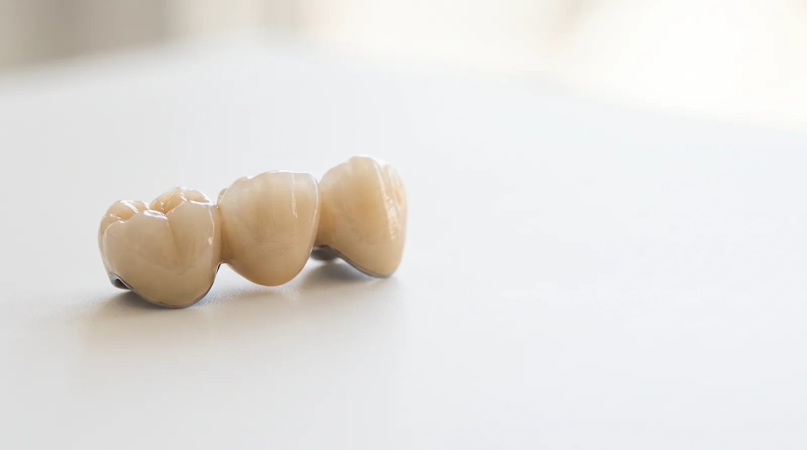 Close-up of a three unit ceramic dental bridge